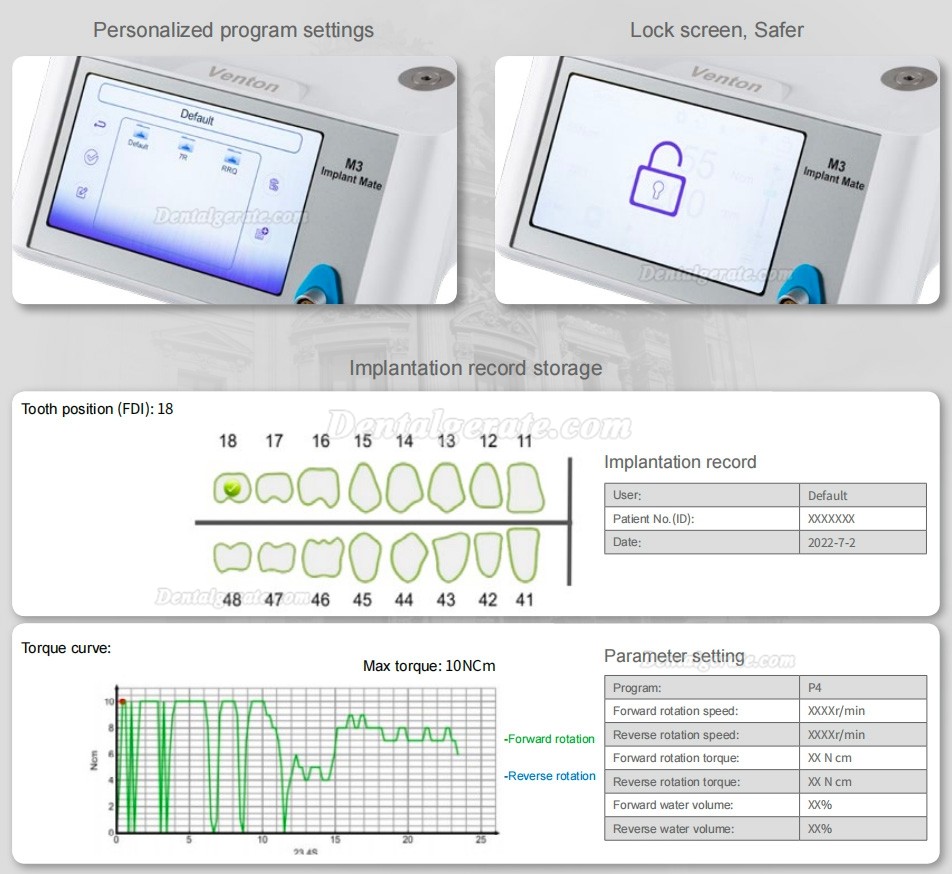 Dental B&uuml;rstenloser Implantatmotor Physiodispenser Mate M3